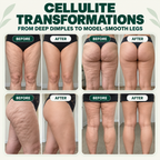 Cellulite transformation proof wall.